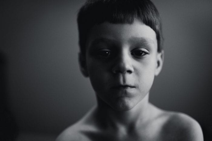 FR Castor 6 JustLikeMe 700x467 - FR_Castor_6_JustLikeMe