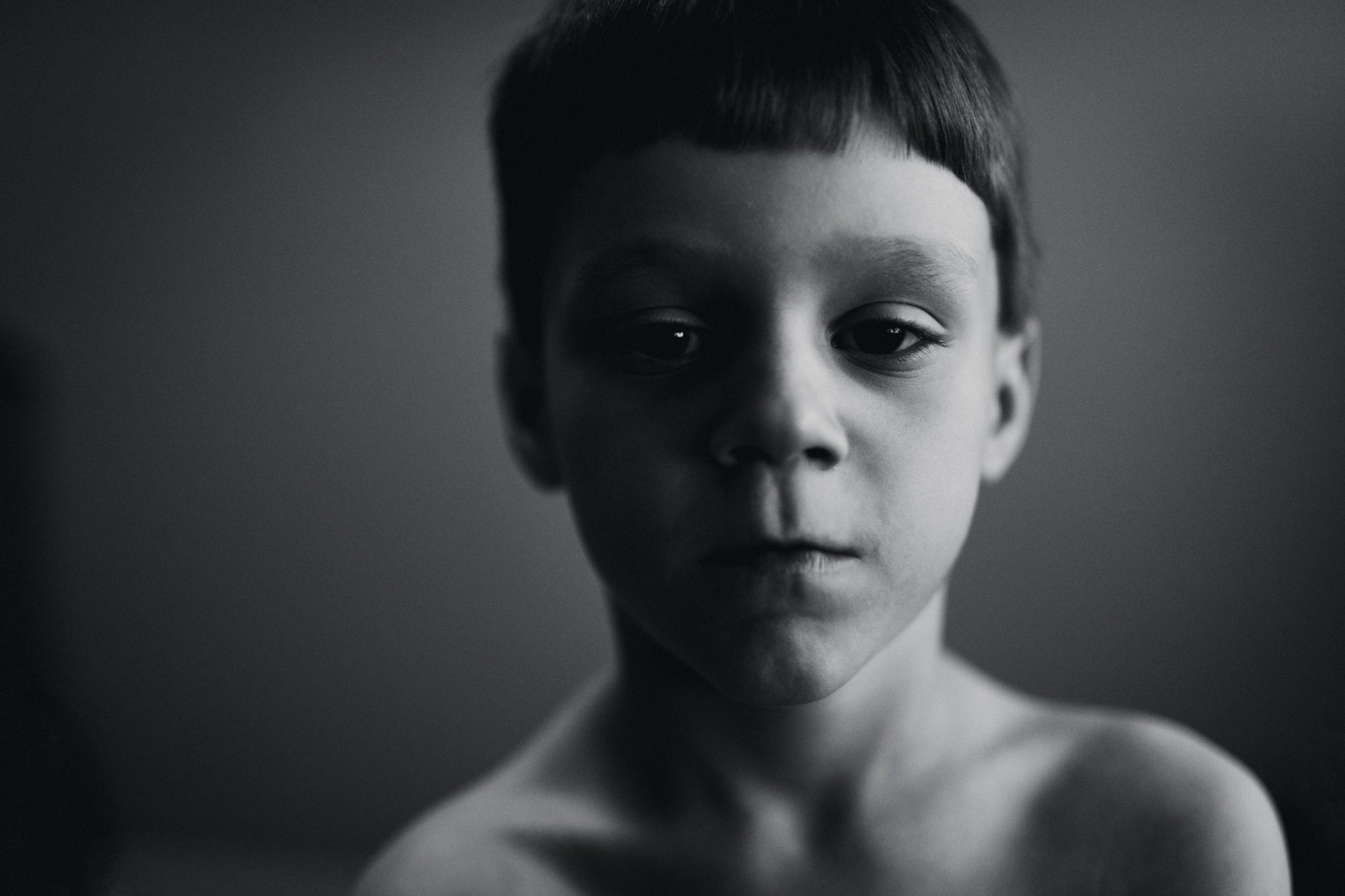 FR Castor 6 JustLikeMe - Just Like Me - A MFA Photography Thesis